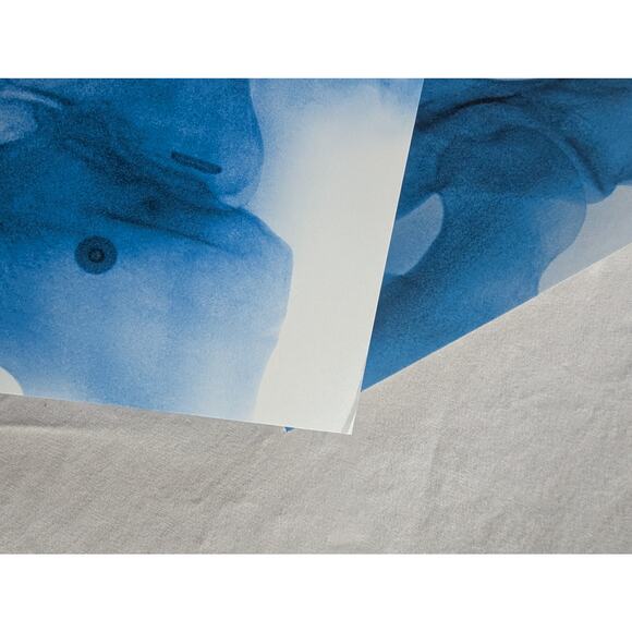 Lorde Signed Vinyl Virgin LP Autographed X-Ray Picture Disc - Picture 8 of 16